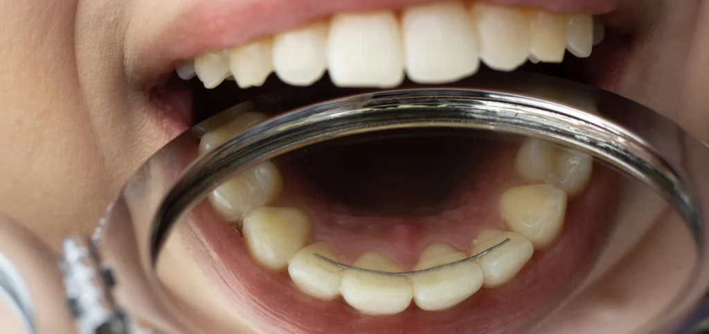 Orthodontiste enfants Bouillargues 30230
