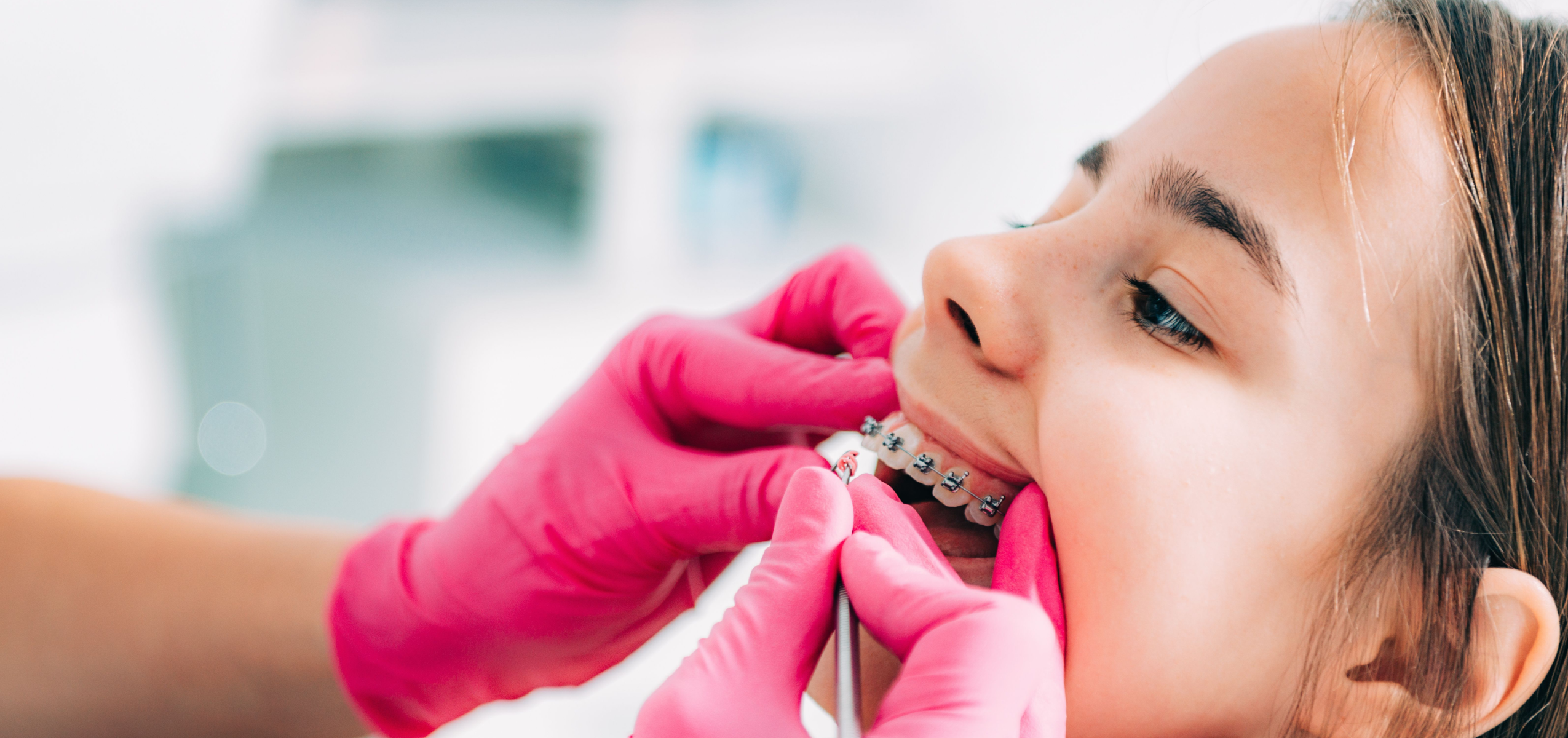 Orthodontiste Adolescents Bouillargues 30230
