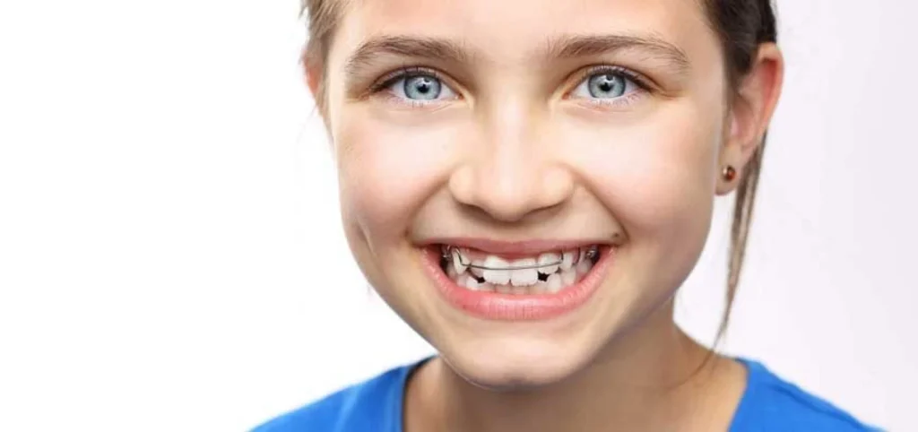 Orthodontiste enfants à Bouillargues