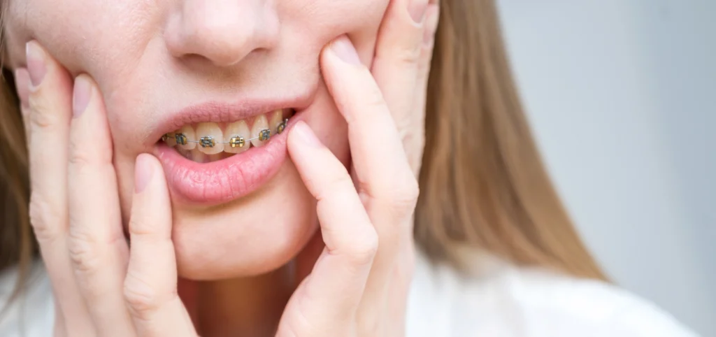 Incidents en orthodontie