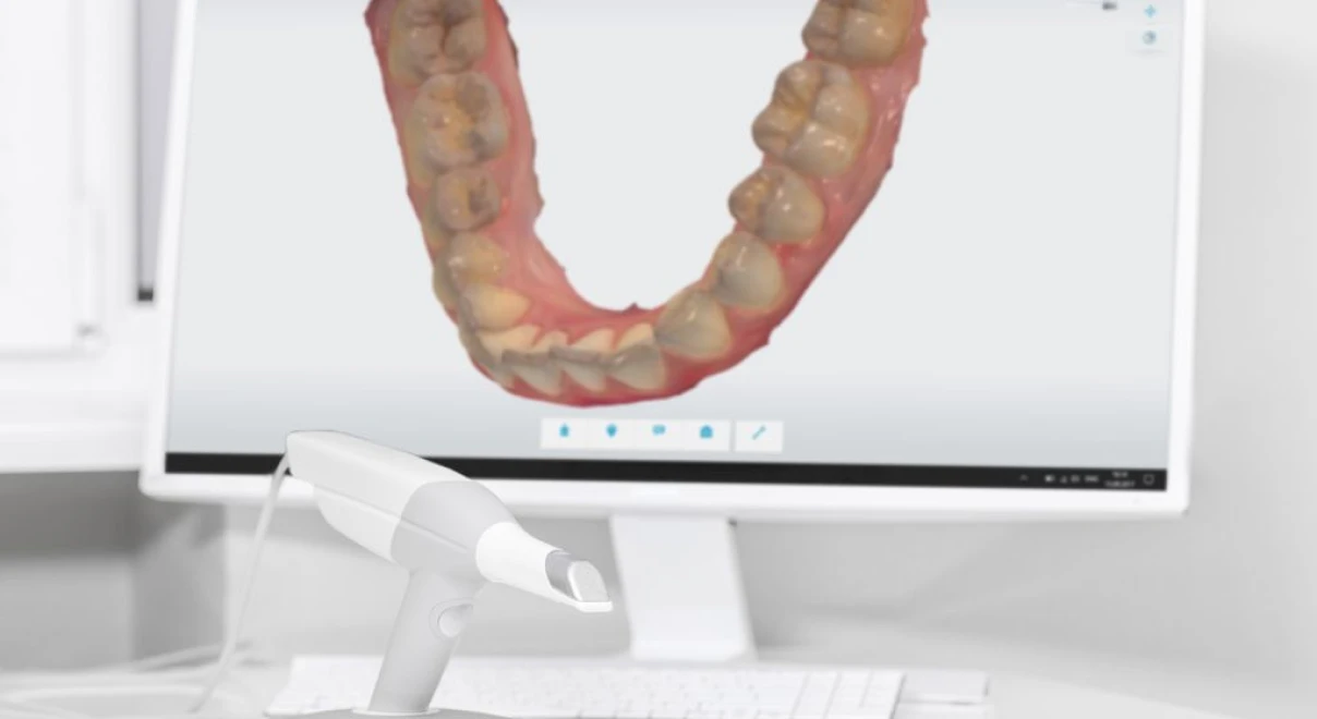 orthodontiste-nimes-aligneurs