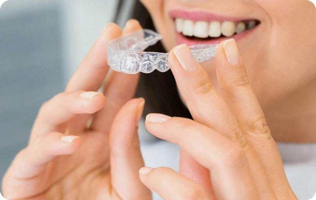 Mise en place d’un aligneur transparent sur les dents