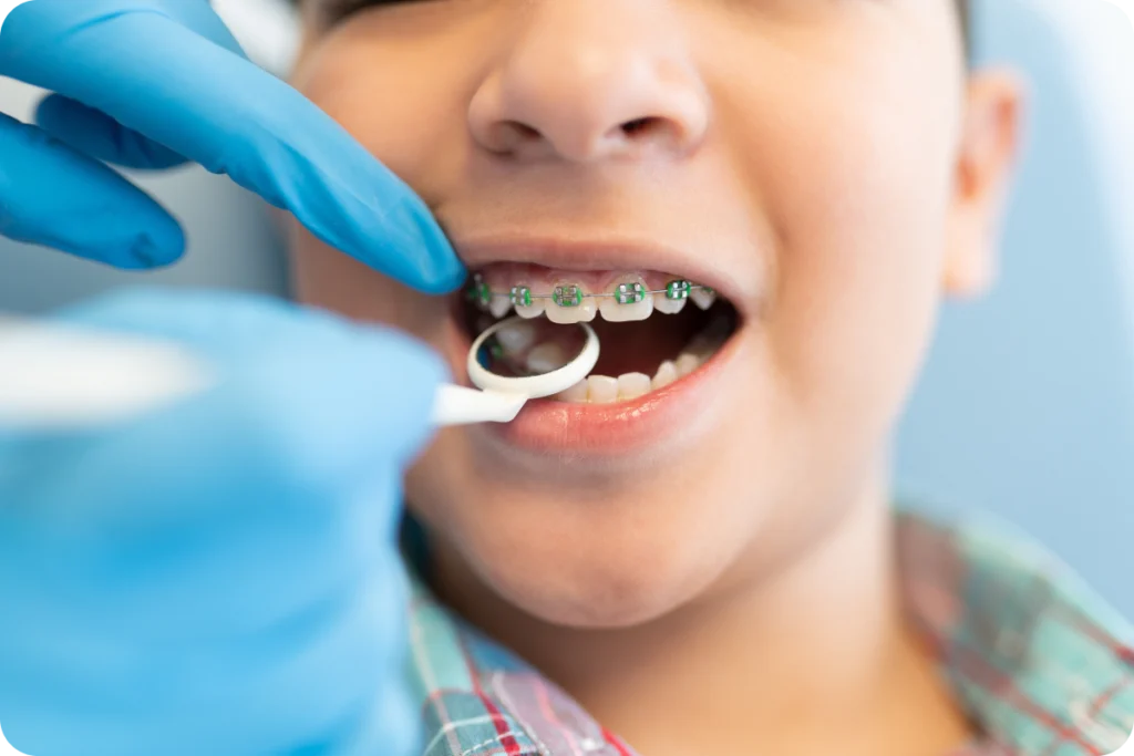 Contrôle d’un appareil multi-attaches chez un enfant
