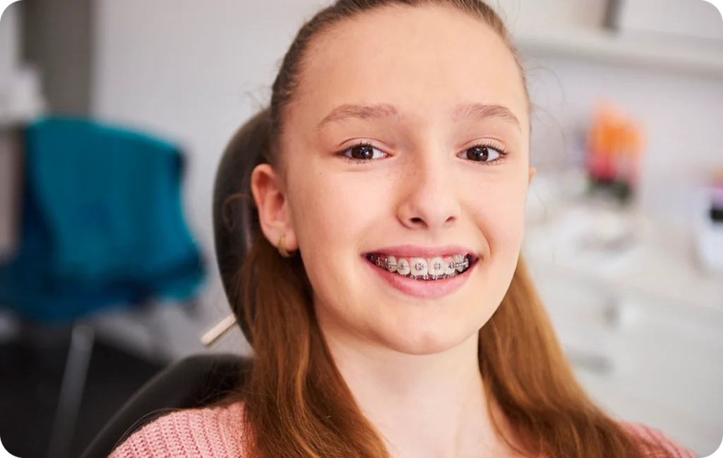 Adolescente souriante portant un appareil orthodontique multi-attaches