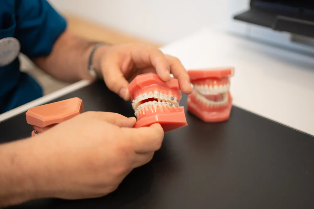 Explication d’un traitement orthodontique sur un modèle dentaire avec attaches